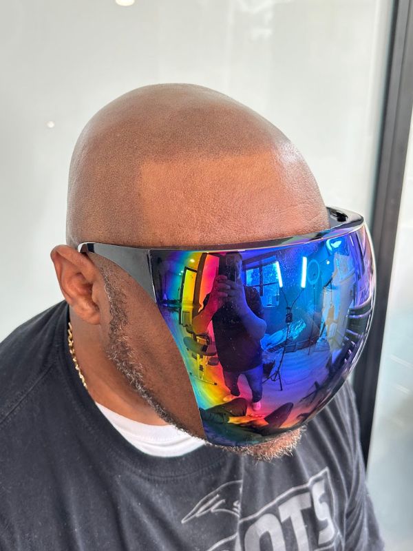 After full scalp micropigmentation treatment with a shaved hair look