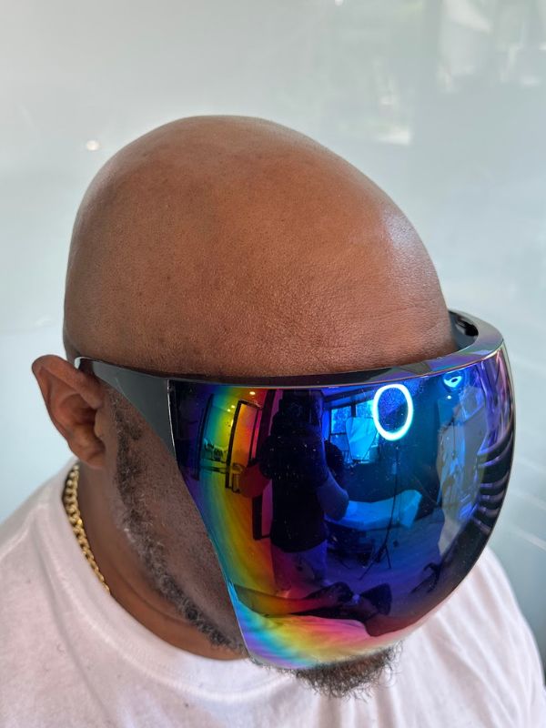 Before full scalp micropigmentation treatment by Bik near Boston