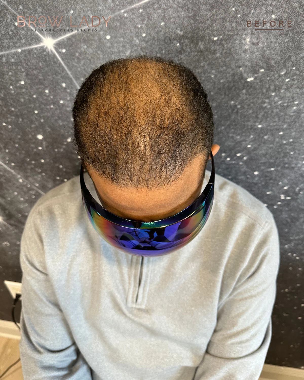 BEFORE SMP Density Fill result by Bik Shrestha at Brow Lady near Boston