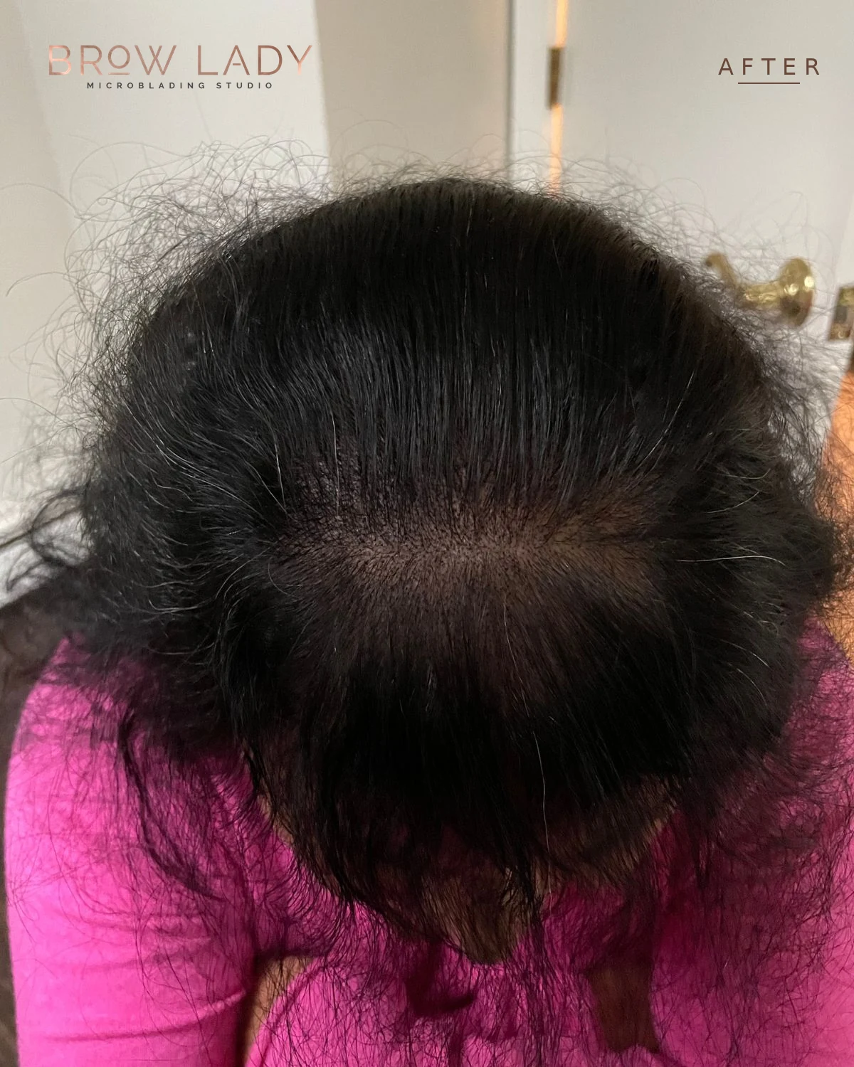 AFTER SMP Density Fill result by Bik Shrestha at Brow Lady near Boston
