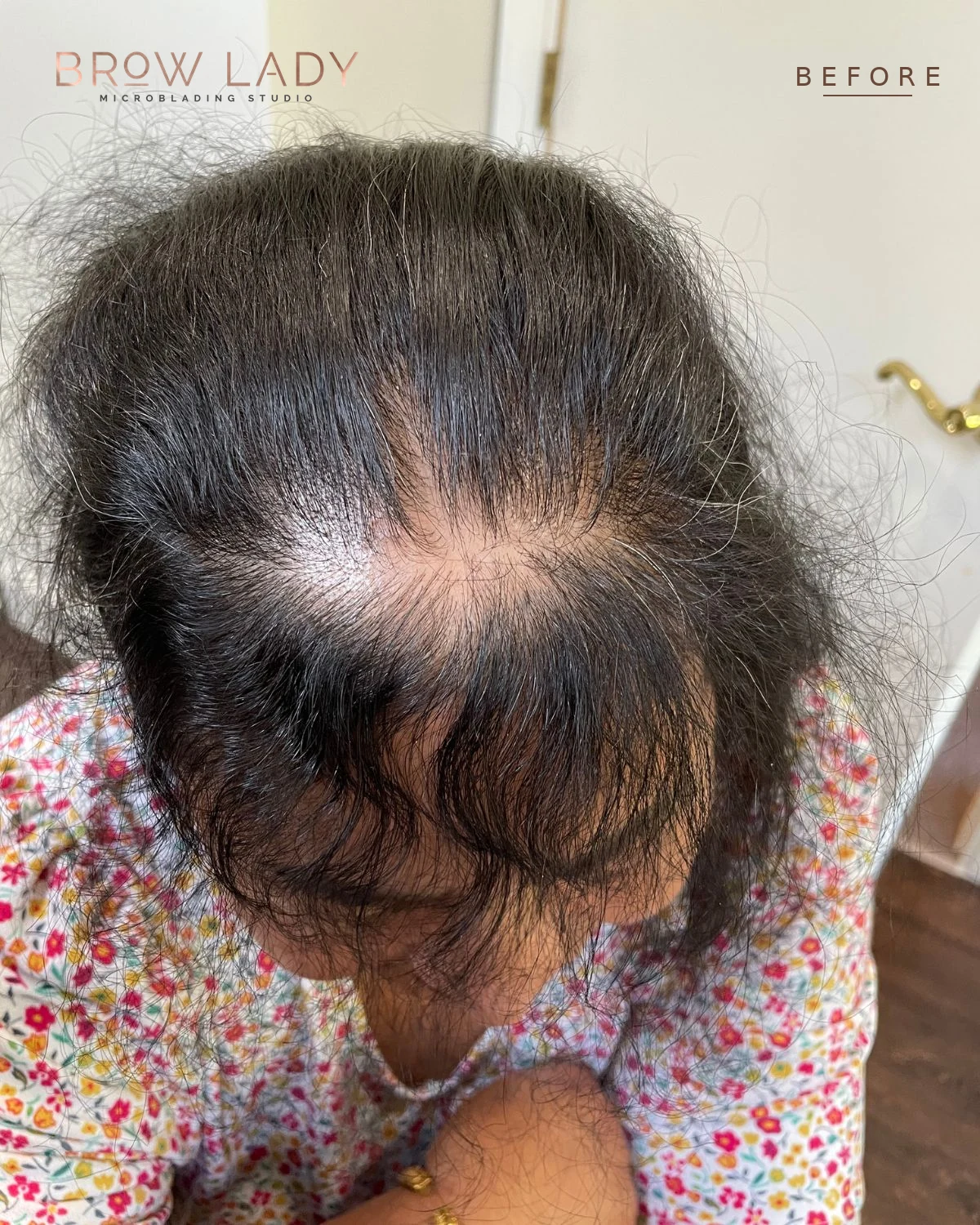 BEFORE SMP Density Fill result by Bik Shrestha at Brow Lady near Boston