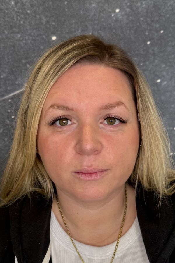 Bare brows before nano brows