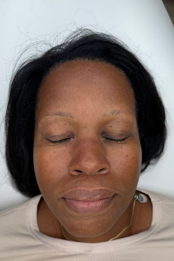 Bare brows before nano combo brows in Boston