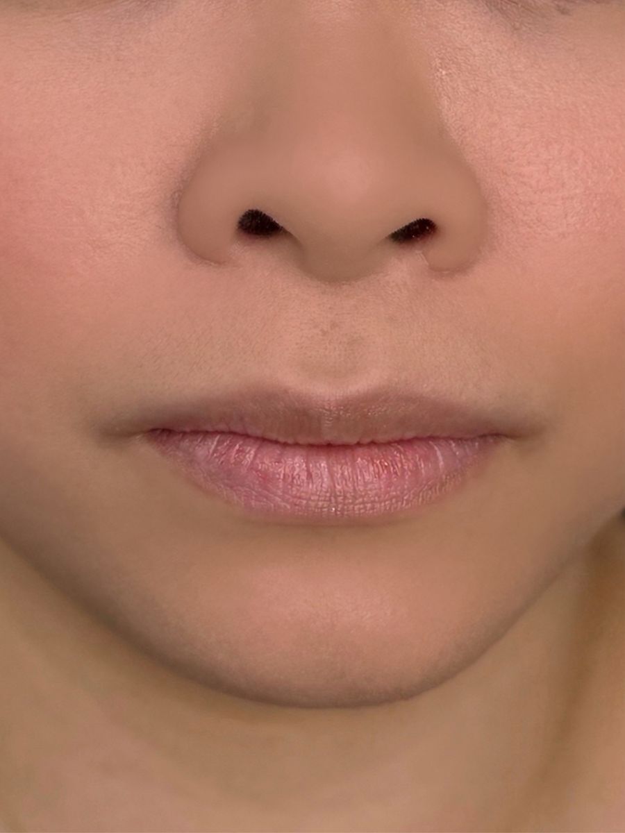 Before Lip Blush treatment for a client from Lowell, Massachusetts