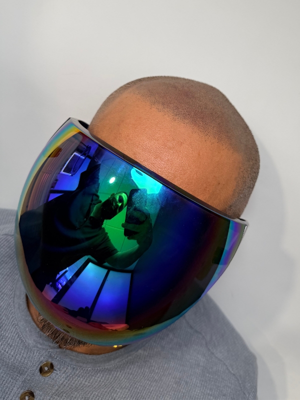 Natural-looking scalp micropigmentation result by Bik serving Greater Boston